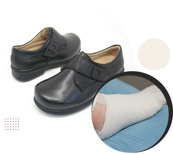 Two photos showing an example of custom made footwear by Stride.